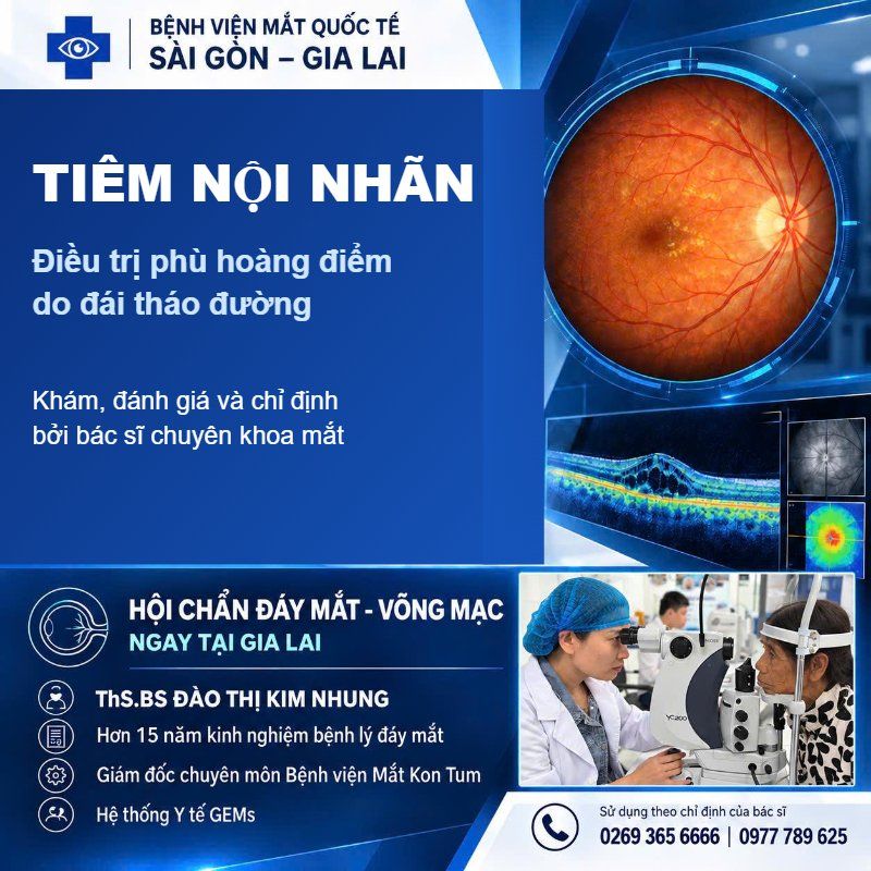 Tiêm nội nhãn điều trị phù hoàng điểm do đái tháo đường tại BV Mắt Quốc tế Sài Gòn – Gia Lai